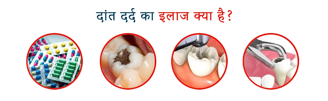 What is the treatment for toothache
